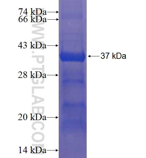 CERK fusion protein Ag22774 SDS-PAGE
