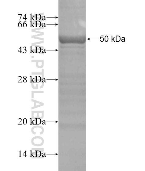 CERKL fusion protein Ag19728 SDS-PAGE CERKL fusion protein Ag19728 SDS-PAGE