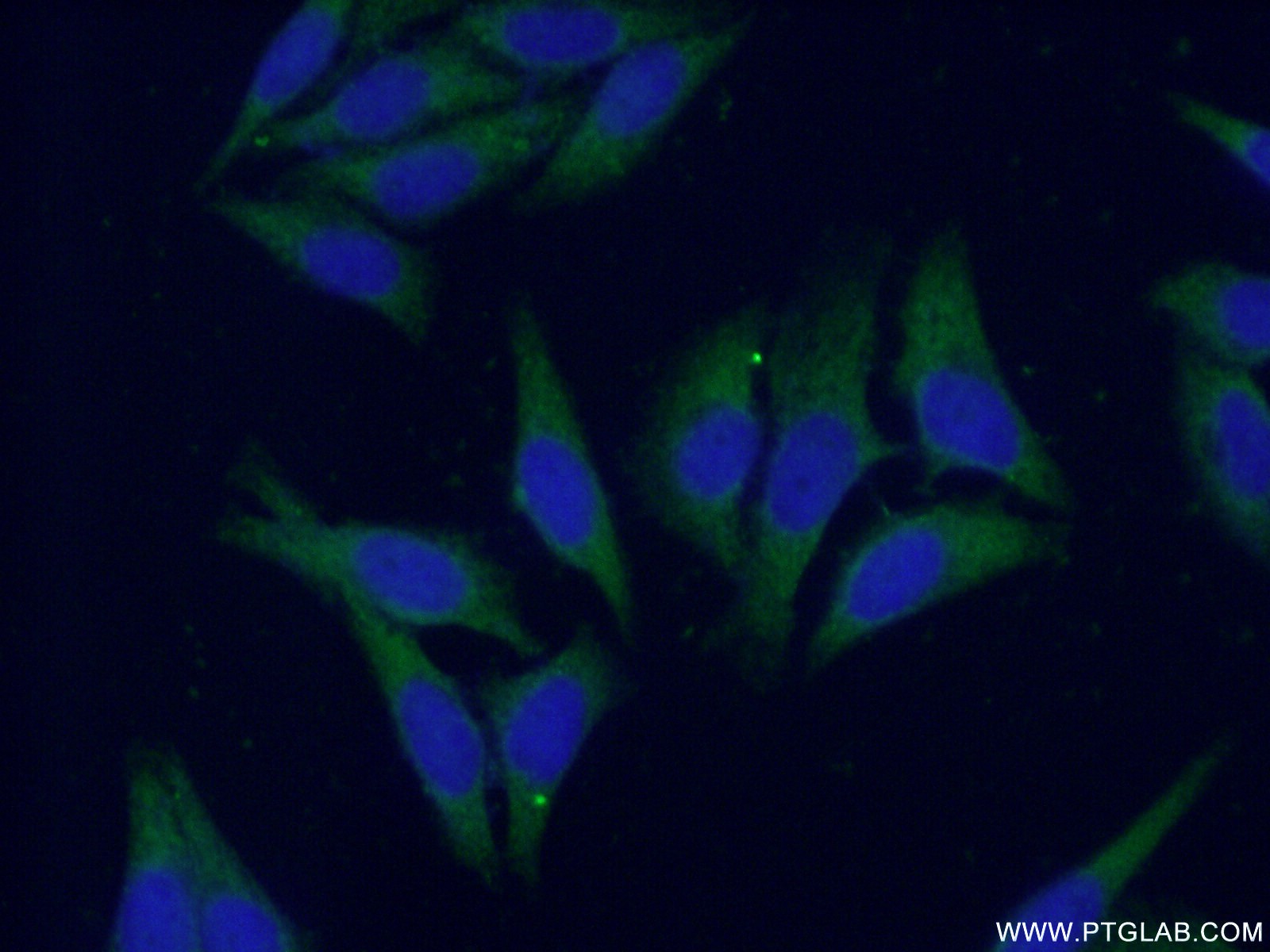 IF Staining of HepG2 using 16912-1-AP