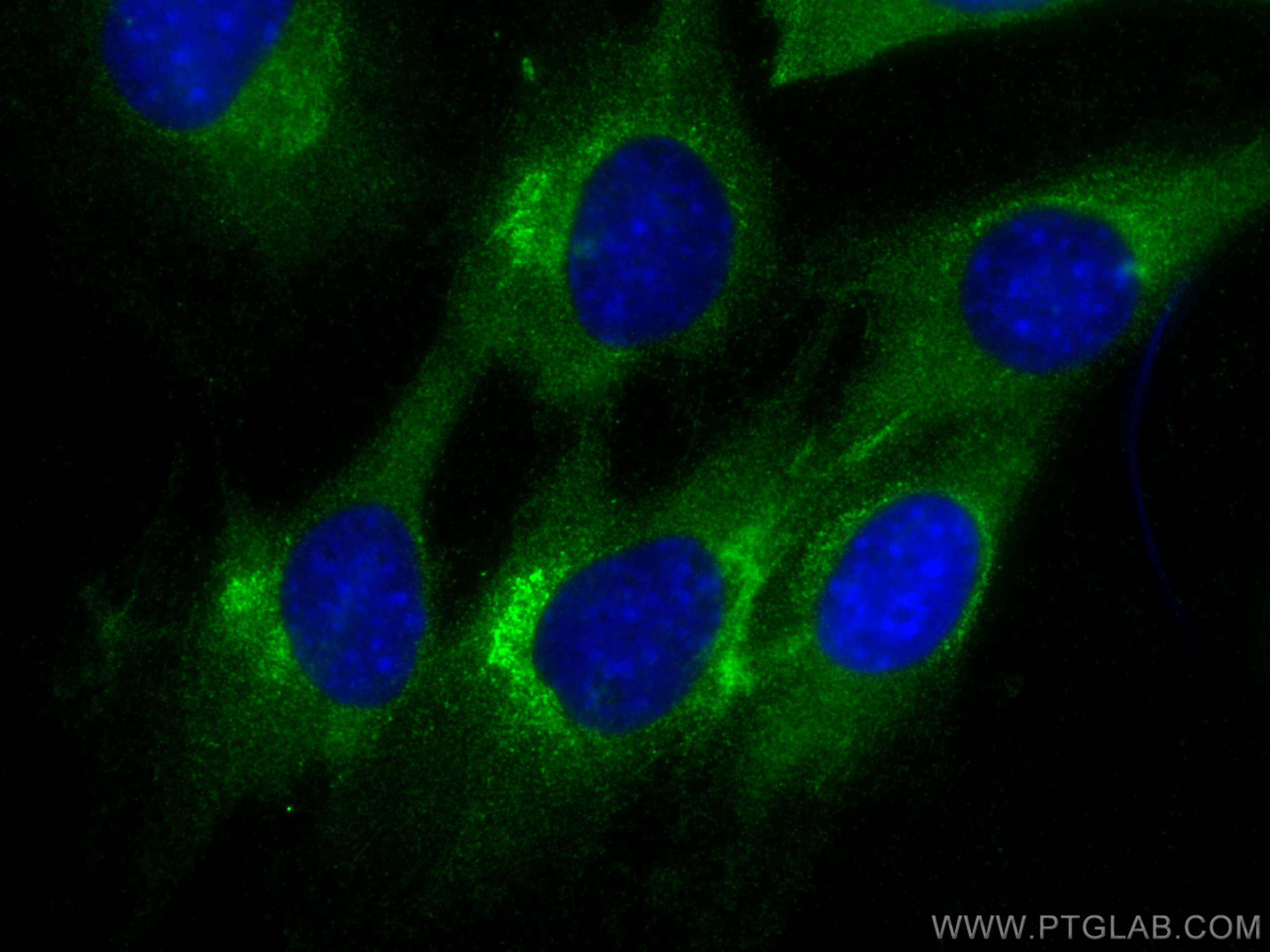 IF Staining of C2C12 using 29041-1-AP (same clone as 29041-1-PBS)