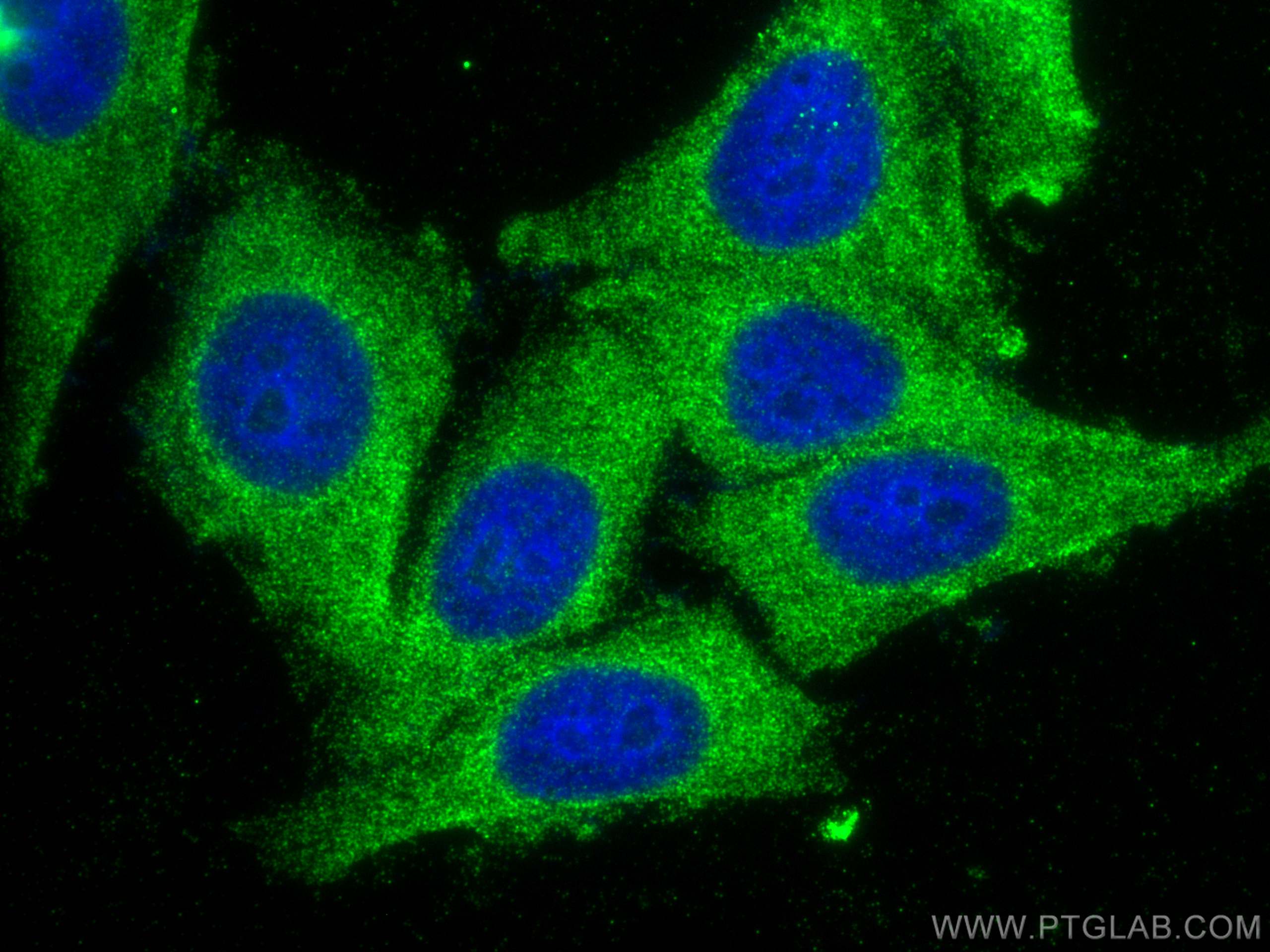 IF Staining of HepG2 using 29041-1-AP (same clone as 29041-1-PBS)