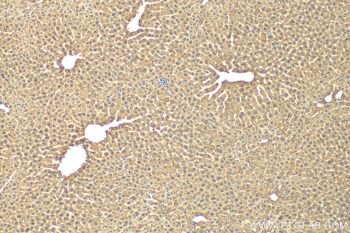 IHC staining of mouse liver using 29041-1-AP (same clone as 29041-1-PBS)