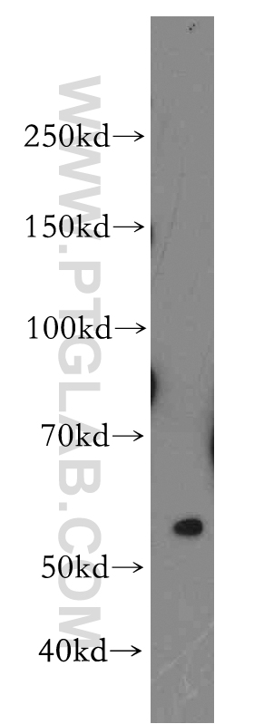 WB analysis of HepG2 using 19520-1-AP