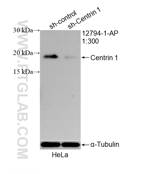 WB analysis of HeLa using 12794-1-AP