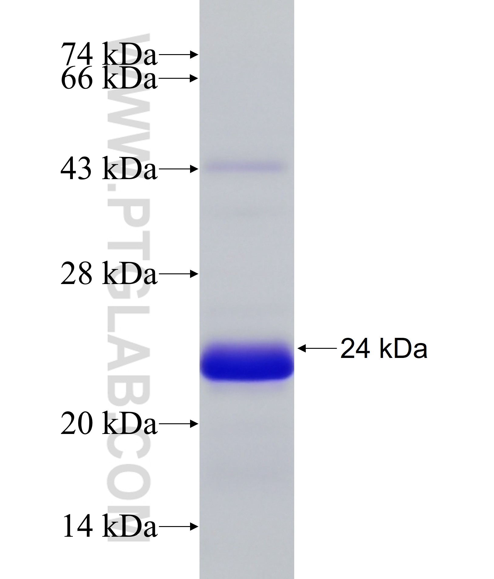 CETN1 fusion protein Ag33734 SDS-PAGE CETN1 fusion protein Ag33734 SDS-PAGE