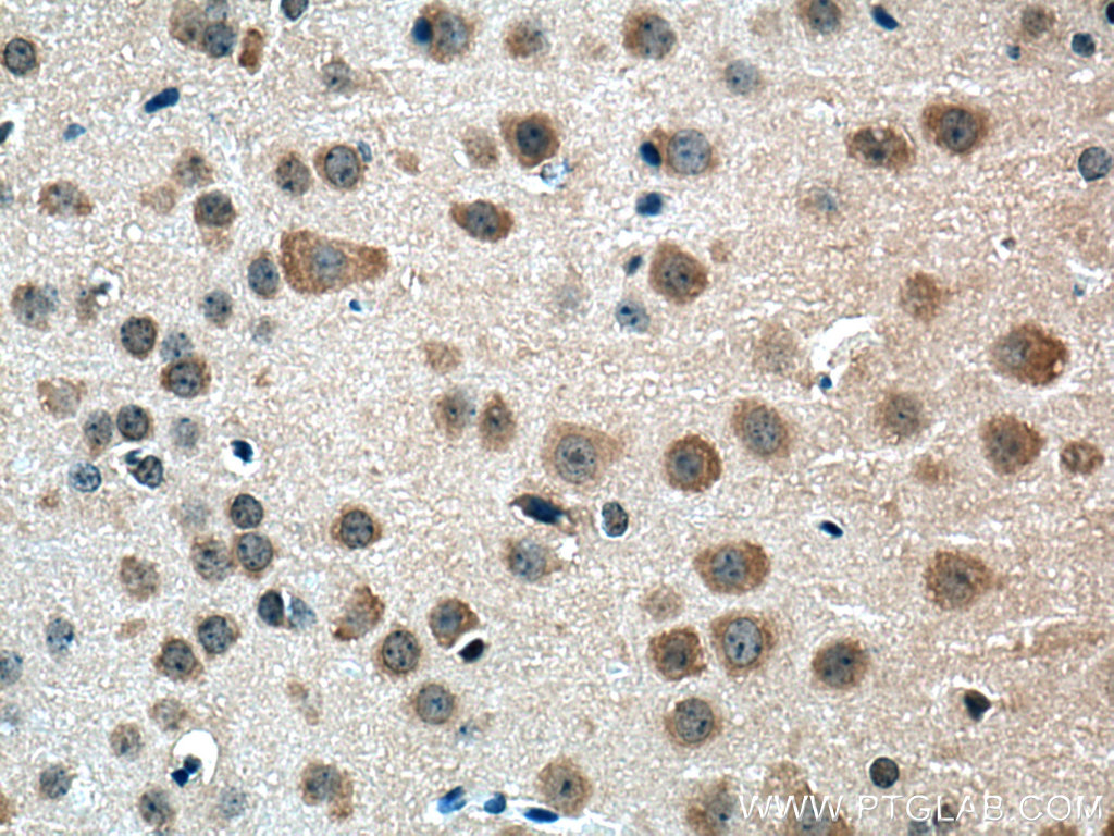 IHC staining of mouse brain using 15877-1-AP