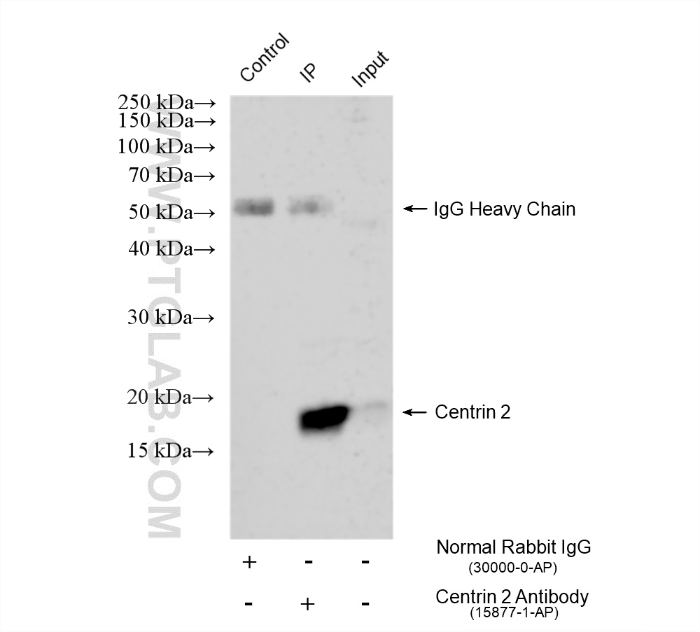 IP experiment of mouse brain using 15877-1-AP IP experiment of mouse brain using 15877-1-AP