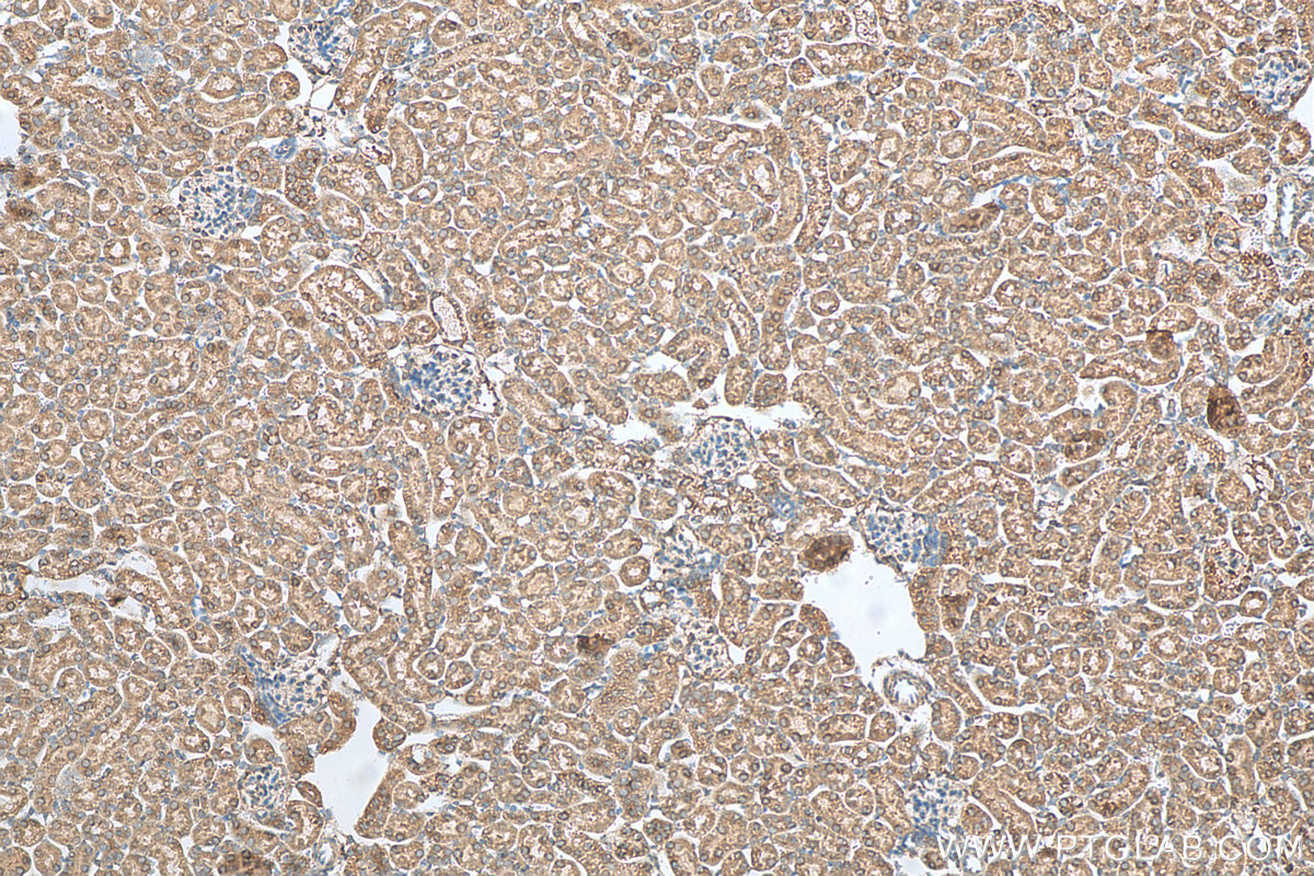 IHC staining of mouse kidney using 15811-1-AP