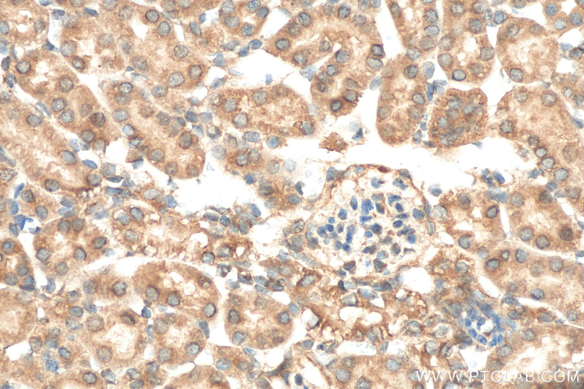 IHC staining of mouse kidney using 15811-1-AP