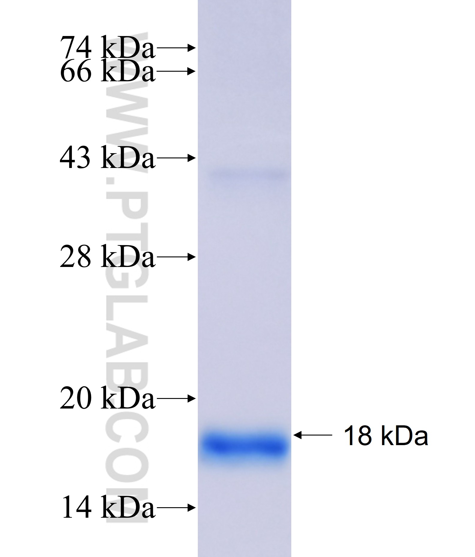 CFAP141 fusion protein Ag37822 SDS-PAGE CFAP141 fusion protein Ag37822 SDS-PAGE
