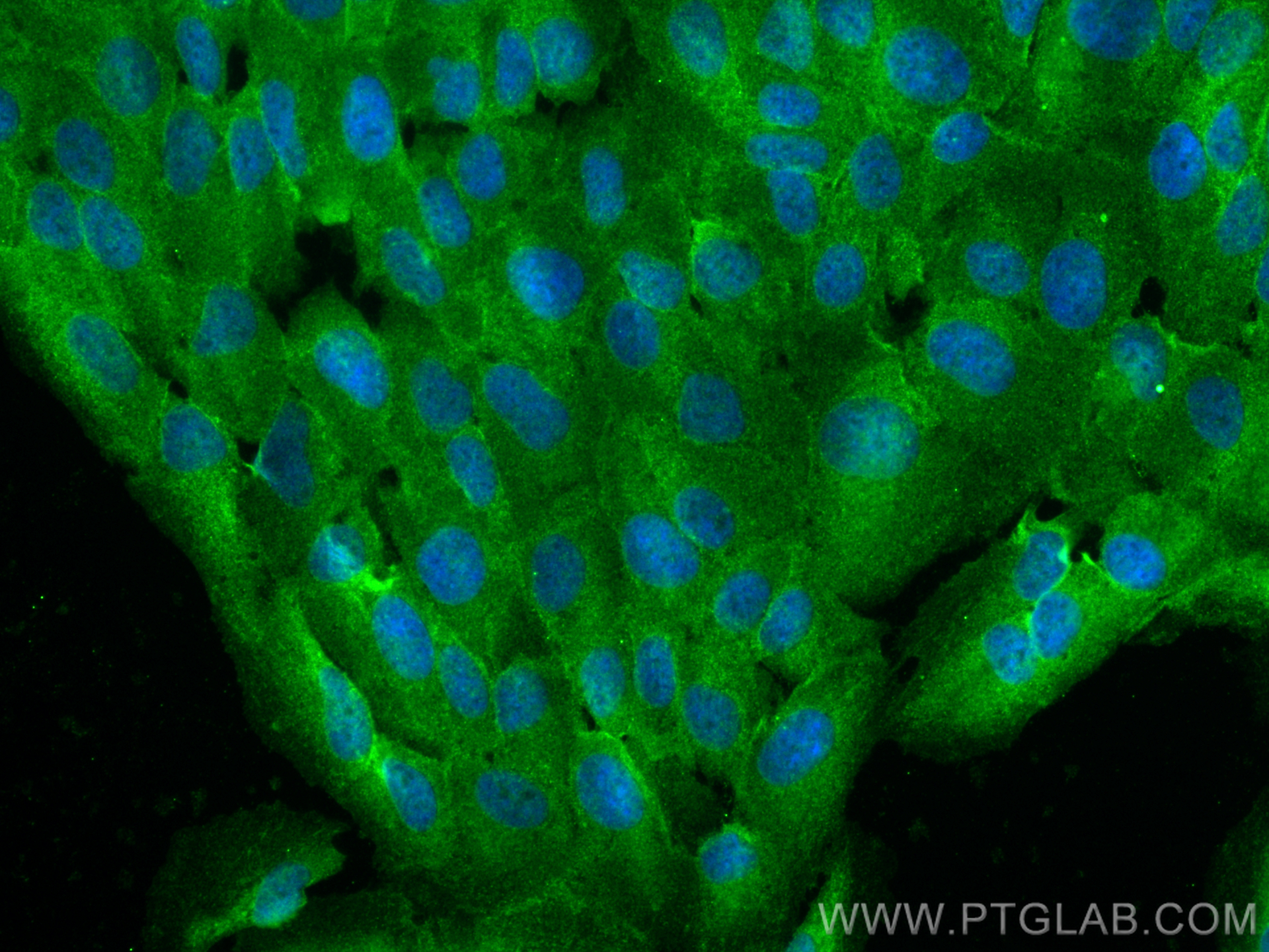 IF Staining of hTERT-RPE1 using 30579-1-AP IF Staining of hTERT-RPE1 using 30579-1-AP