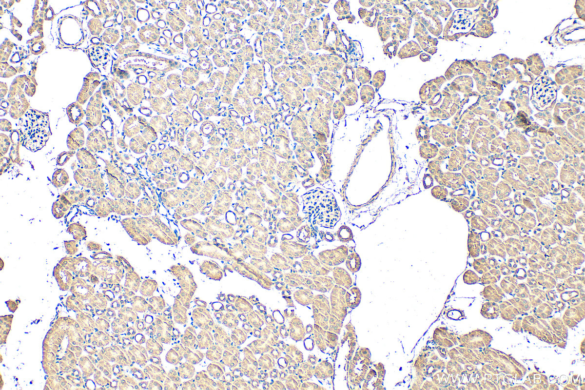 IHC staining of mouse kidney using 30579-1-AP IHC staining of mouse kidney using 30579-1-AP