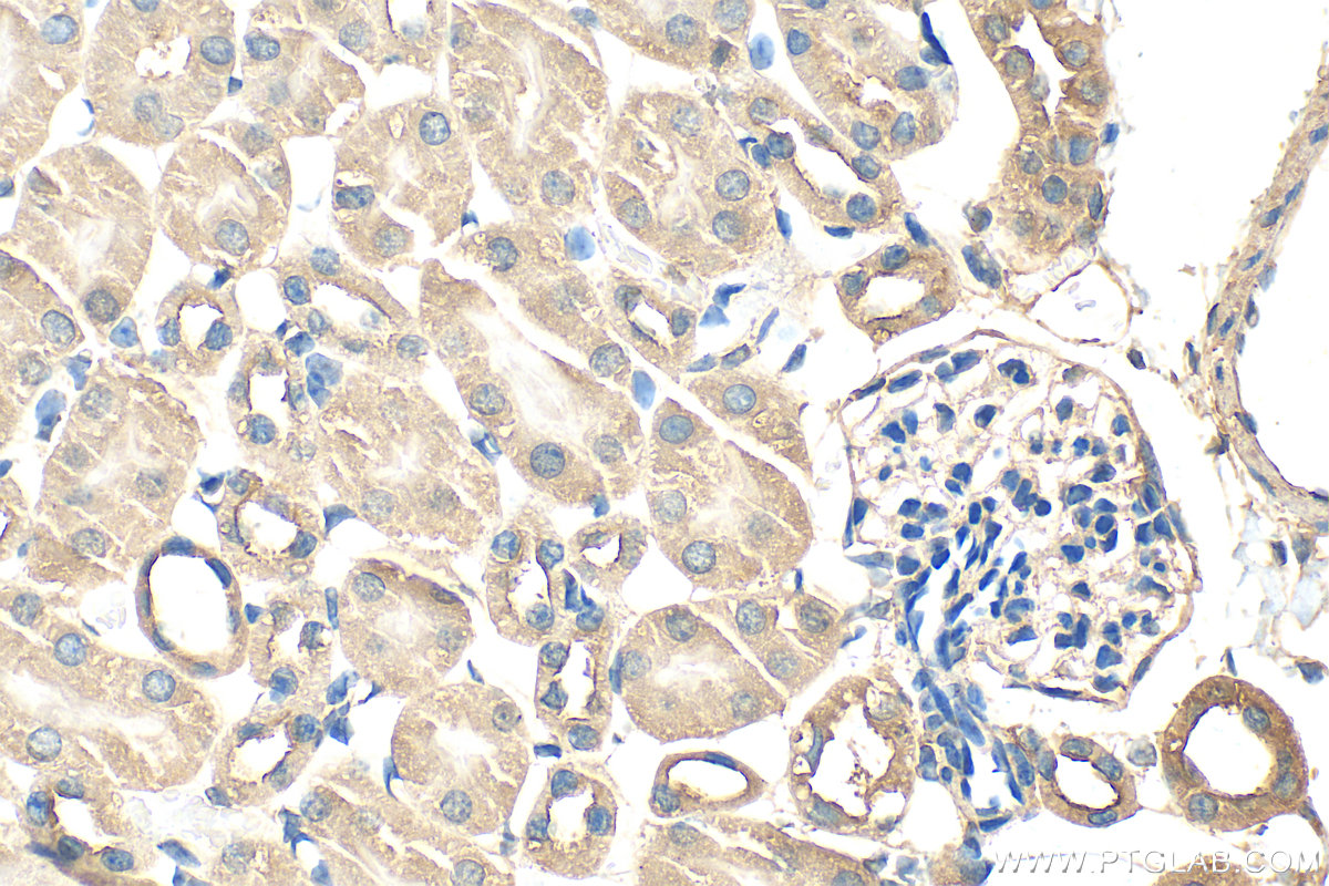 IHC staining of mouse kidney using 30579-1-AP IHC staining of mouse kidney using 30579-1-AP