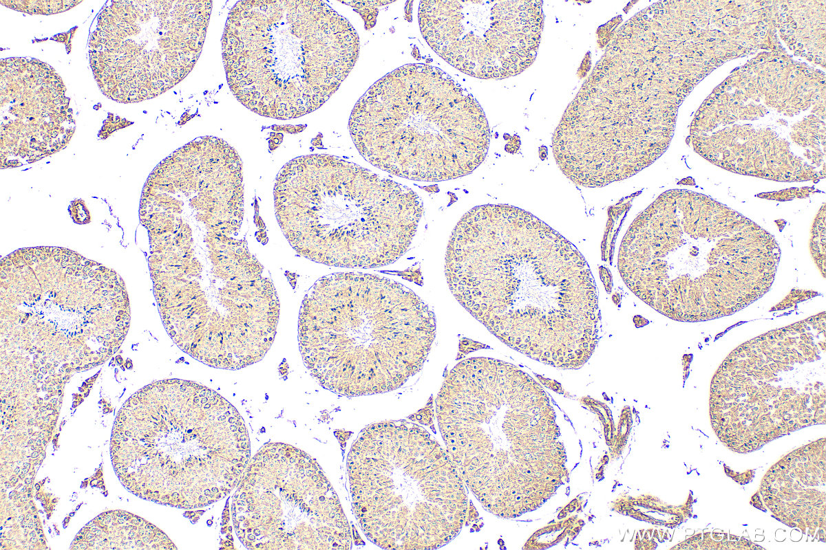IHC staining of mouse testis using 30579-1-AP IHC staining of mouse testis using 30579-1-AP