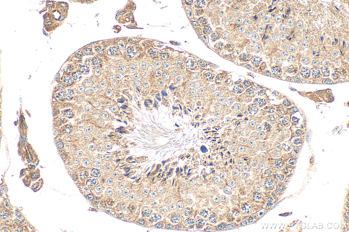 IHC staining of mouse testis using 30579-1-AP IHC staining of mouse testis using 30579-1-AP