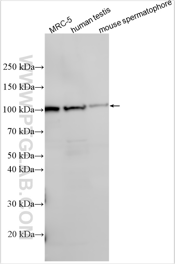 WB analysis using 30579-1-AP WB analysis using 30579-1-AP