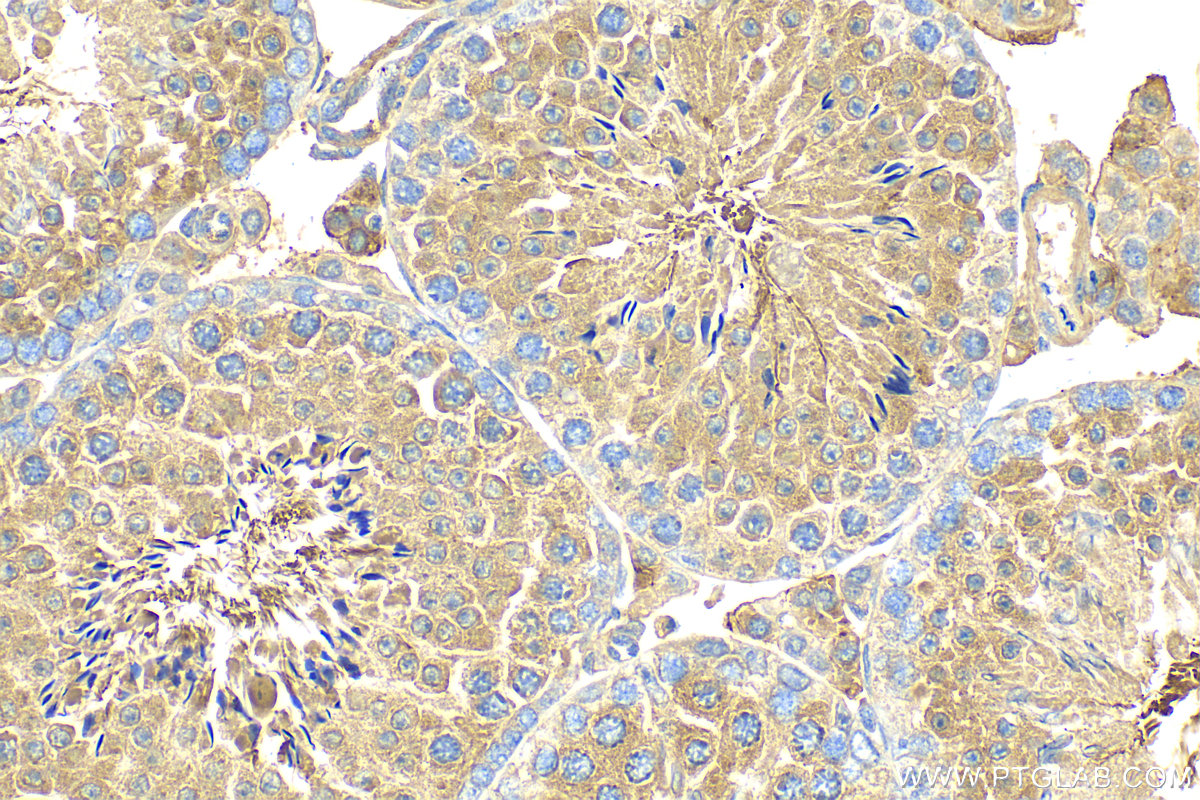 IHC staining of mouse testis using 31344-1-AP