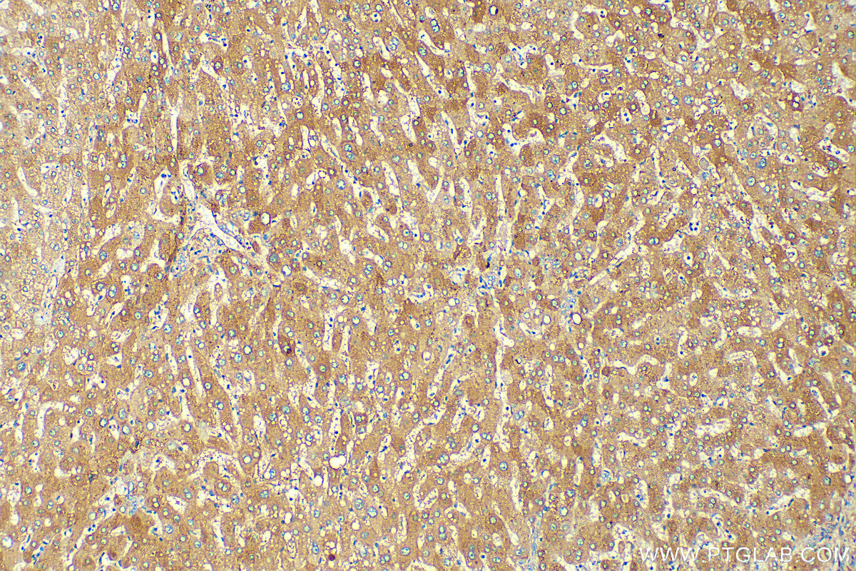 IHC staining of human liver using 10170-1-AP