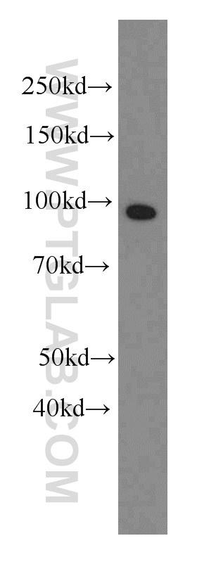 Complement factor B Monoclonal antibody