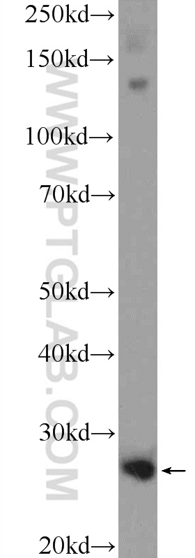 Complement factor D