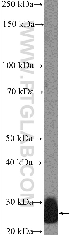 WB analysis of human plasma using 26050-1-AP