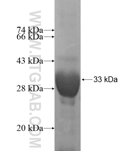 CFD fusion protein Ag11548 SDS-PAGE