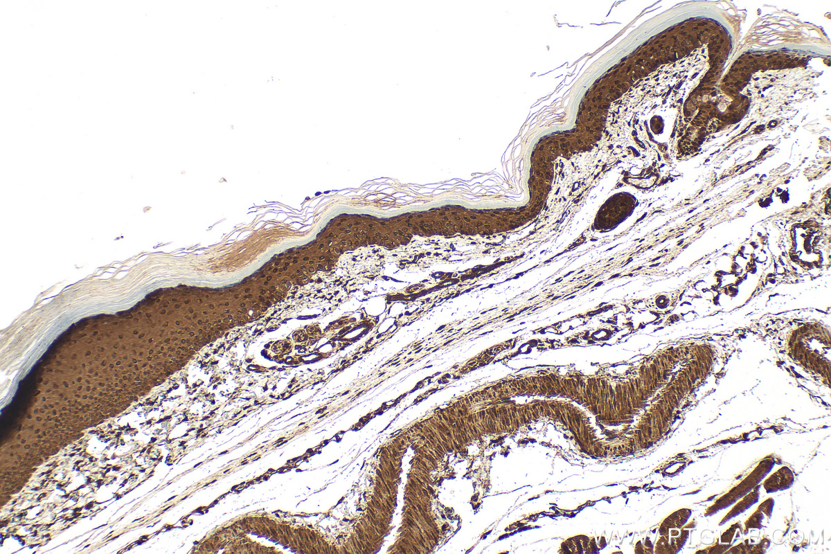 Immunohistochemical analysis of paraffin-embedded mouse skin tissue slide using 26636-1-AP (CFDP1 antibody) at dilution of 1:200 (under 10x lens). Heat mediated antigen retrieval with Tris-EDTA buffer (pH 9.0). IHC staining of mouse skin using 26636-1-AP