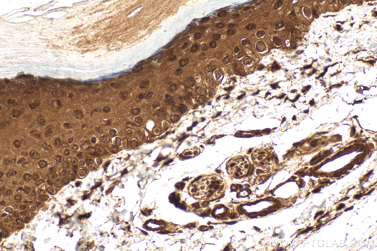 Immunohistochemical analysis of paraffin-embedded mouse skin tissue slide using 26636-1-AP (CFDP1 antibody) at dilution of 1:200 (under 40x lens). Heat mediated antigen retrieval with Tris-EDTA buffer (pH 9.0). IHC staining of mouse skin using 26636-1-AP