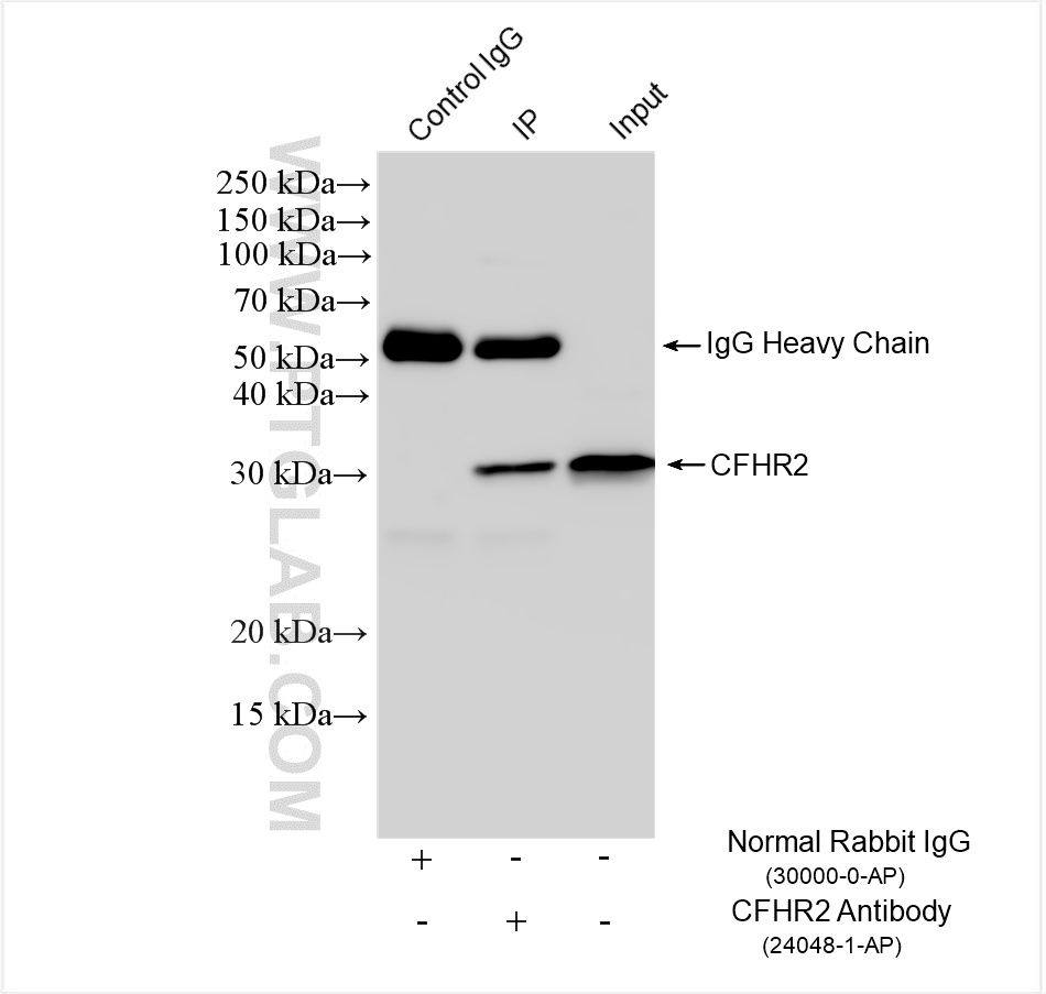 IP result of anti-CFHR2 (IP:24048-1-AP, 4ug; Detection:24048-1-AP 1:1000) with HepG2 cells lysate 1800 ug. IP experiment of HepG2 using 24048-1-AP