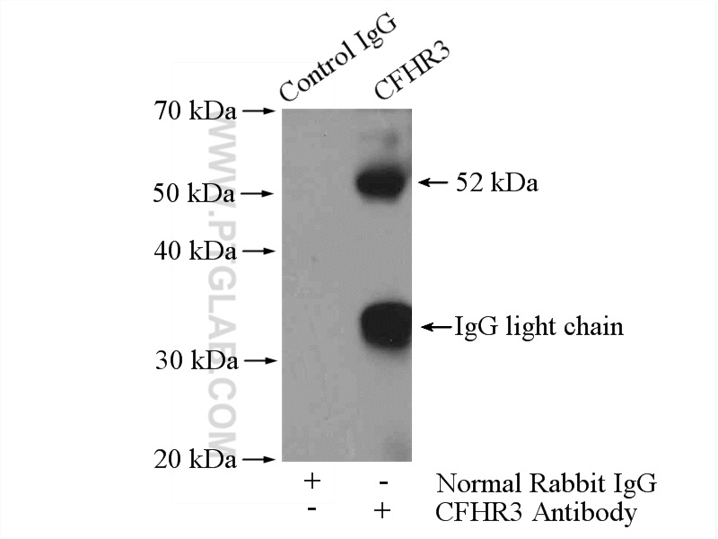 IP experiment of HepG2 using 16583-1-AP