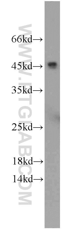 CFHR3 Polyclonal antibody