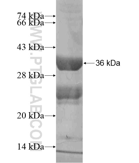 CFHR4 fusion protein Ag19737 SDS-PAGE