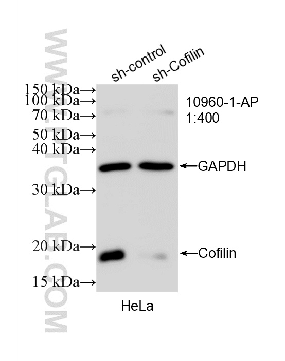 WB analysis of HeLa using 10960-1-AP WB analysis of HeLa using 10960-1-AP