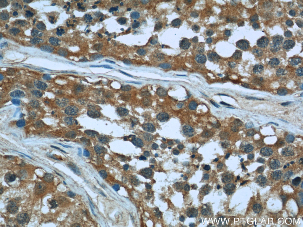 IHC staining of human testis using 66057-1-Ig (same clone as 66057-1-PBS)