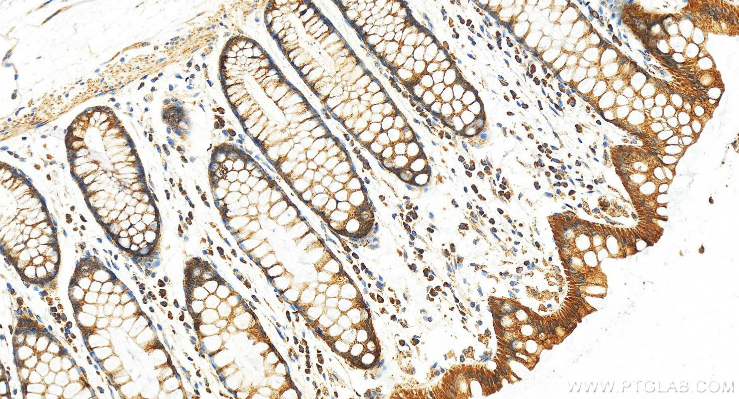 IHC staining of human colon using 11848-1-AP