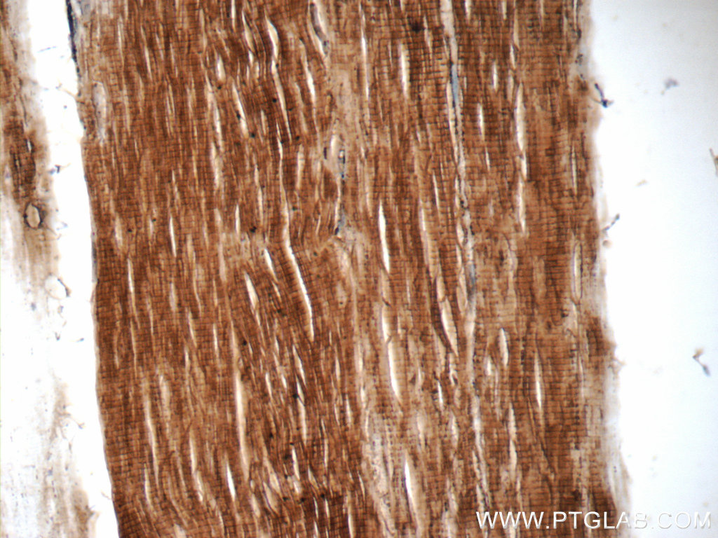 IHC staining of human skeletal muscle using 11848-1-AP