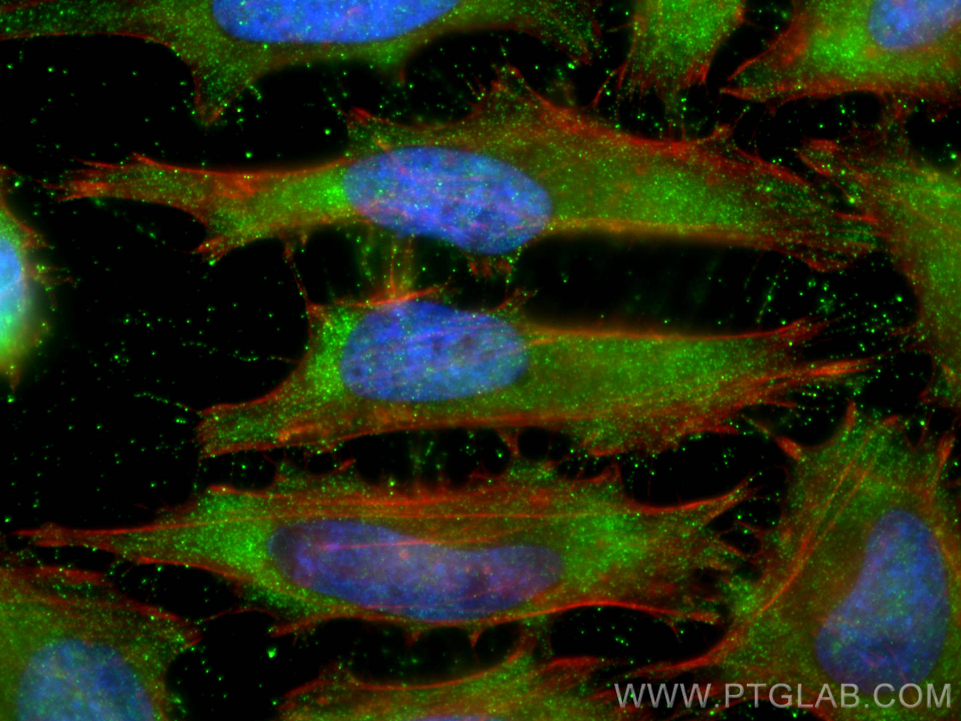 IF Staining of HeLa using 10394-1-AP