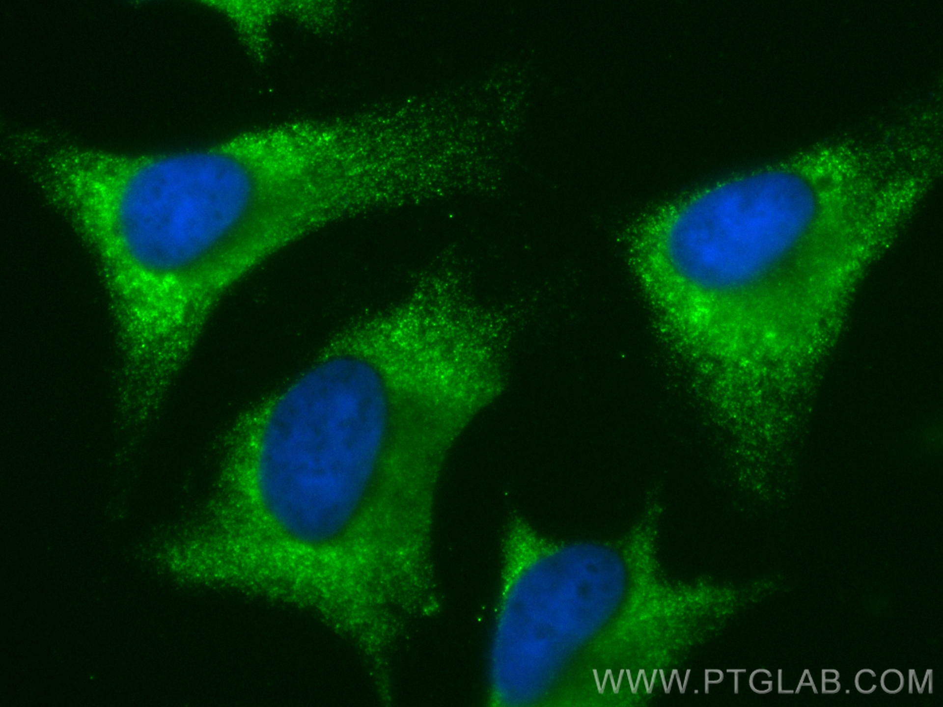 IF Staining of HeLa using CL488-10394