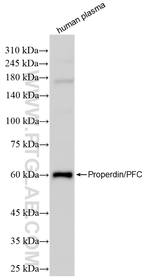 WB analysis of human plasma using 85999-1-RR (same clone as 85999-1-PBS)