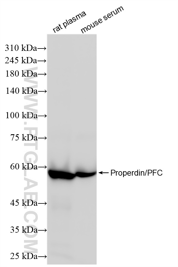 WB analysis using 85999-1-RR (same clone as 85999-1-PBS)