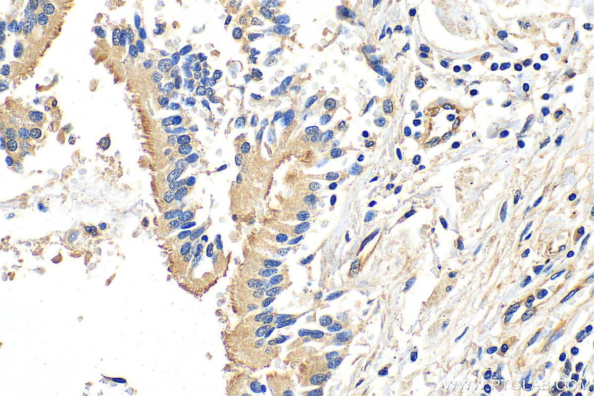 IHC staining of human lung using 20738-1-AP