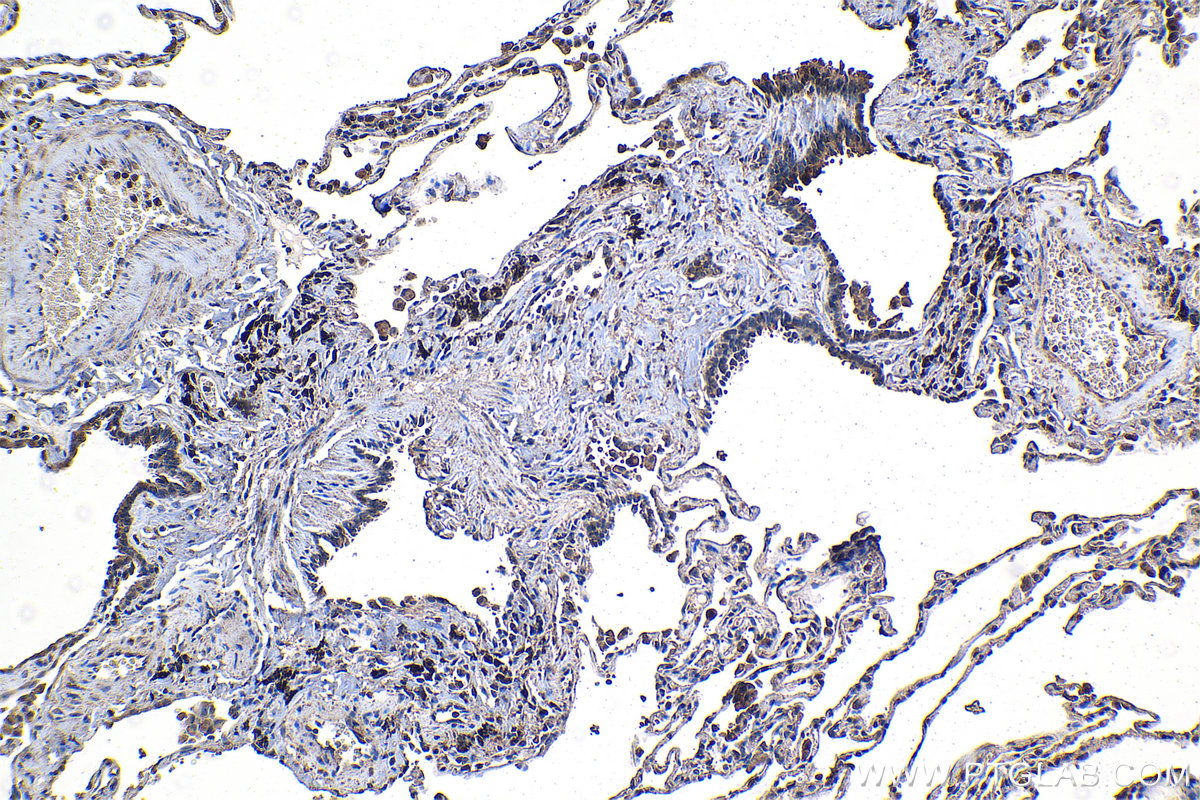 IHC staining of human lung using 66928-1-Ig