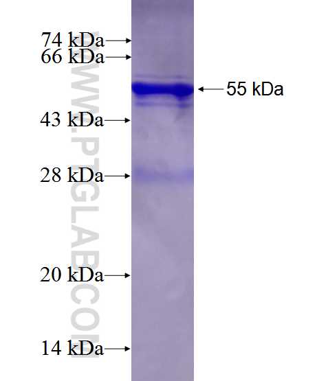 CFTR fusion protein Ag27793 SDS-PAGE CFTR fusion protein Ag27793 SDS-PAGE
