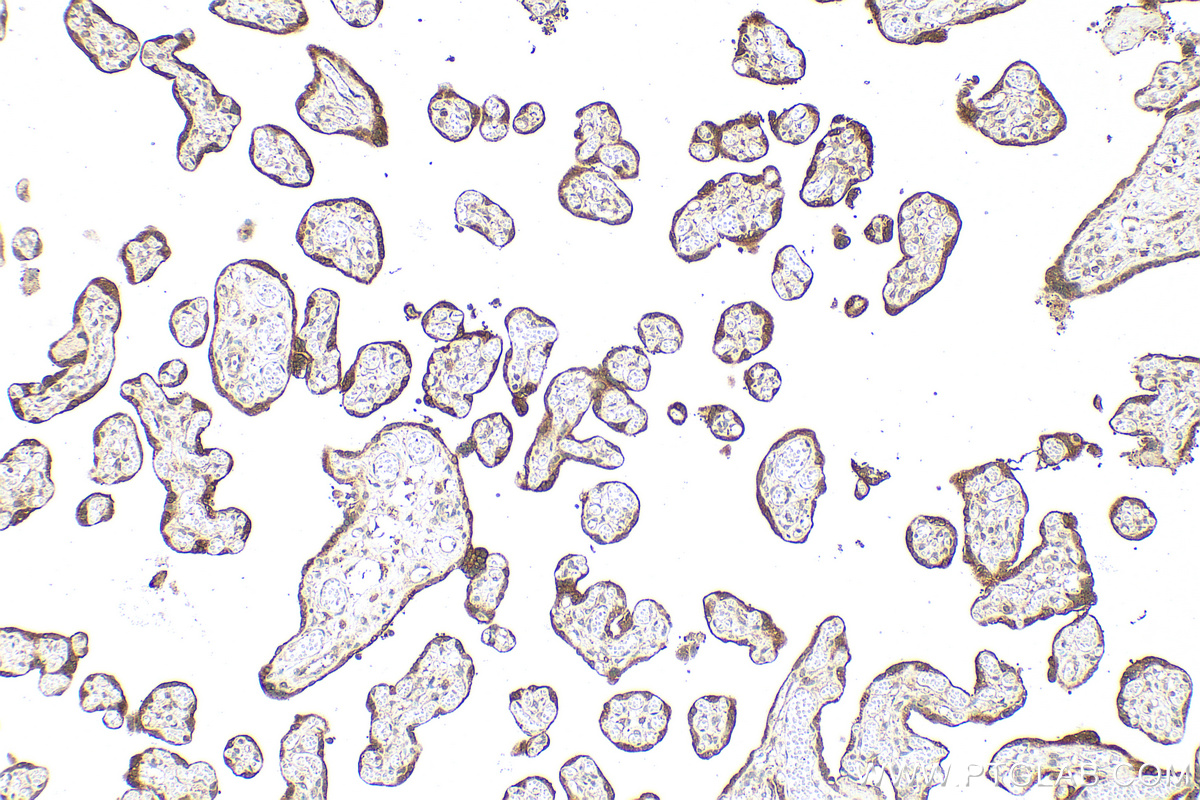 Immunohistochemical analysis of paraffin-embedded human placenta tissue slide using 11615-1-AP (hCG Beta antibody) at dilution of 1:1000 (under 10x lens). Heat mediated antigen retrieval with Tris-EDTA buffer (pH 9.0). IHC staining of human placenta using 11615-1-AP