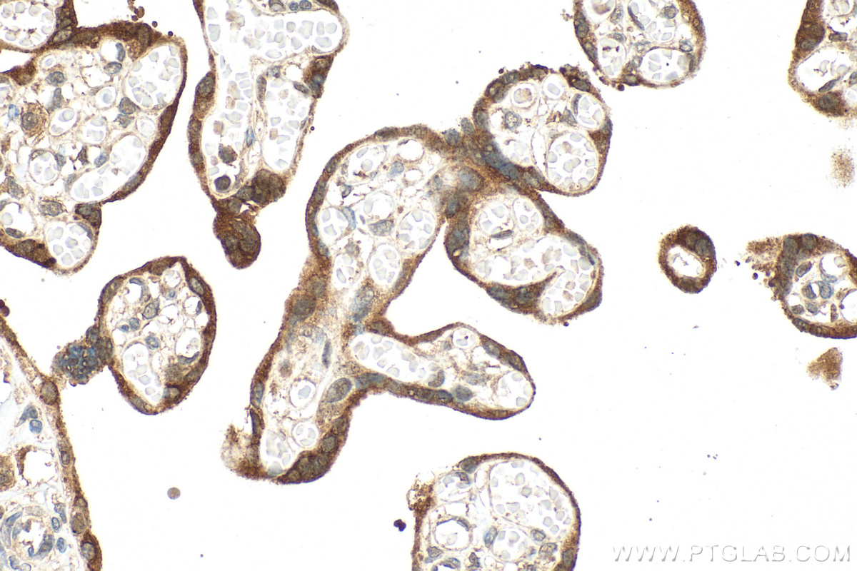 IHC staining of human placenta using 11615-1-AP (same clone as 11615-1-PBS)