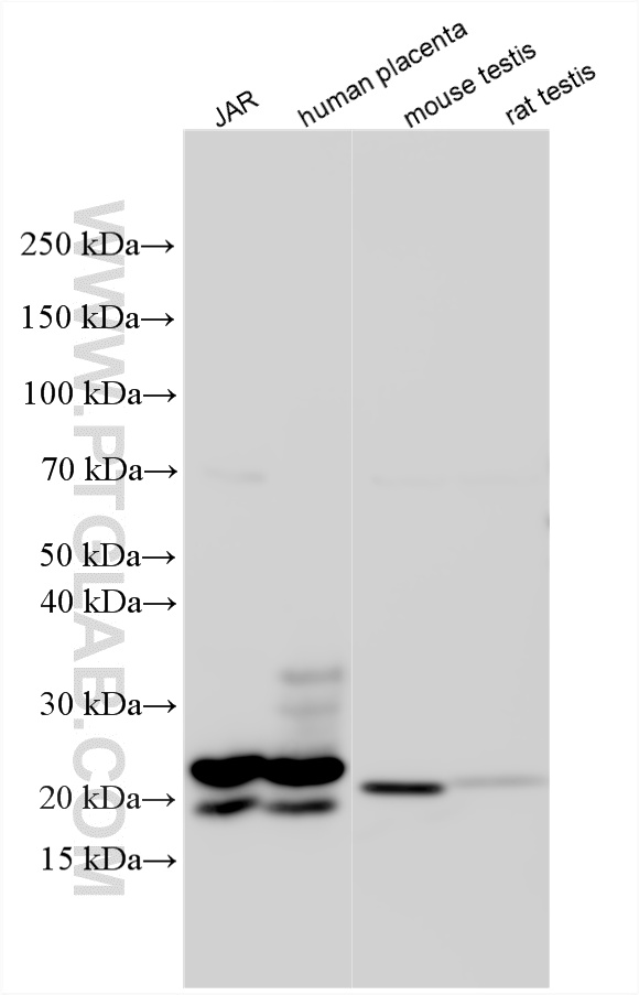 Various lysates were subjected to SDS PAGE followed by western blot with 11615-1-AP (hCG Beta antibody) at dilution of 1:6000 incubated at room temperature for 1.5 hours. WB analysis using 11615-1-AP