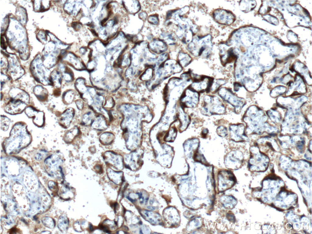 IHC staining of human placenta using 60334-1-Ig (same clone as 60334-1-PBS)