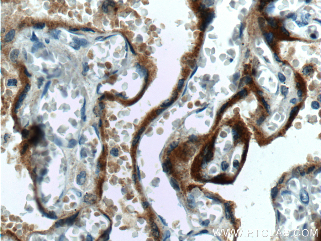 IHC staining of human placenta using 60334-1-Ig (same clone as 60334-1-PBS)