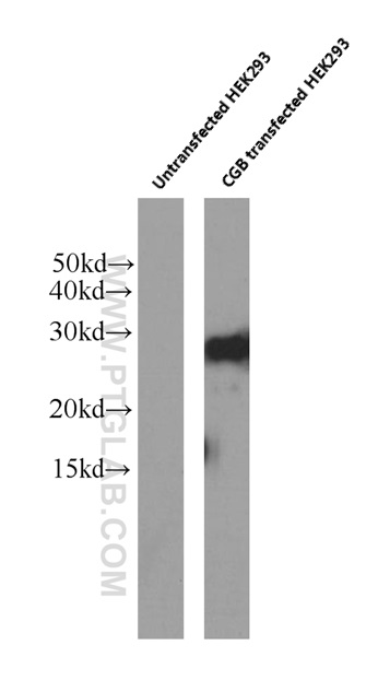 hCG Beta