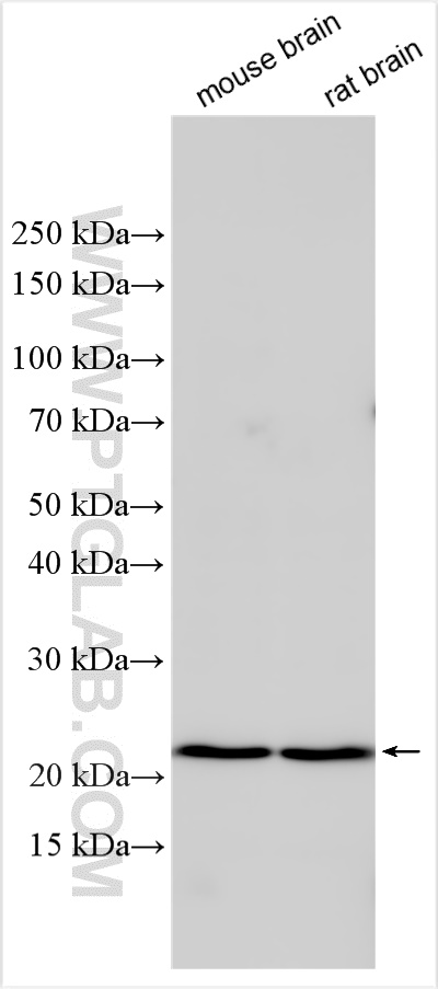 WB analysis using 13323-1-AP